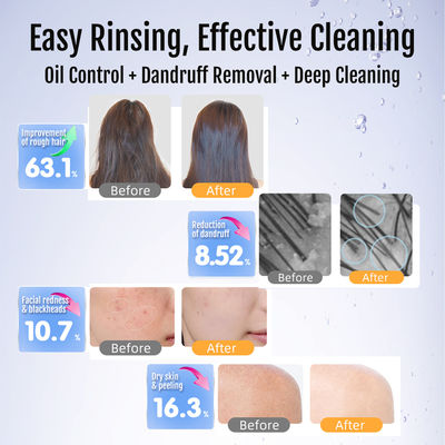 0.1-50 マイクロンの超細薄泡発生器 300%の農薬残留除去と100百万泡/mlの深孔浄化のための泡サイズ